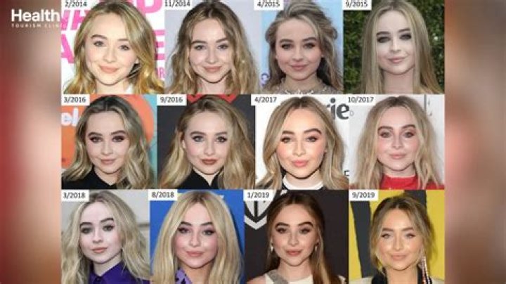 Did Sabrina Carpenter Have Work Done? An In-Depth Analysis