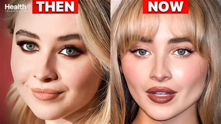Has Sabrina Carpenter Undergone Cosmetic Surgery? An In-Depth Examination