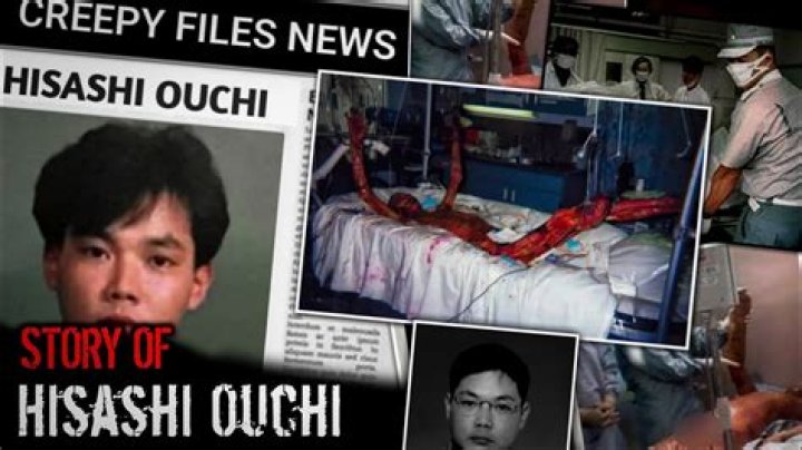 Hisashi Ouchi: The Untold Story Of Day 83