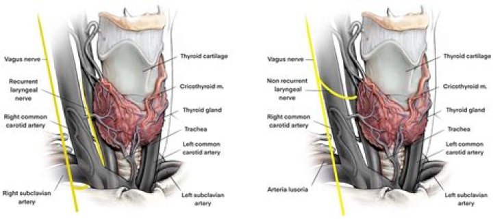 Joyce Vance: Overcoming Thyroid Surgery Challenges