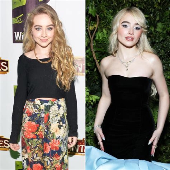 Sabrina Carpenter's Transformation: Unveiling The Truth Behind Her Cheek Fillers