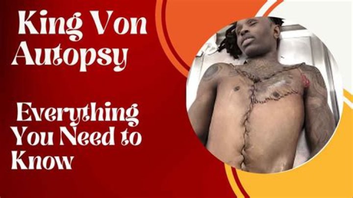 Unraveling The Tragedy: King Von Autopsy Cause Of Death