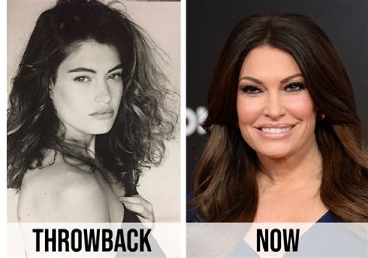 Unveiling The Truth Behind Kimberly Guilfoyle's Plastic Surgery Journey